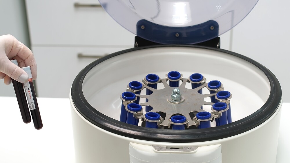 Tıbbi Santrifüj Cihazı Nasıl Çalışır? Prensipler 