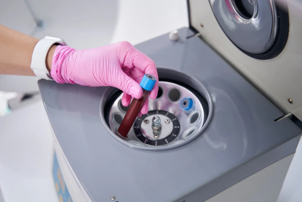 Kaliteli PRP Cihazı ile Hücresel Yenilenmede Yeni Dönem