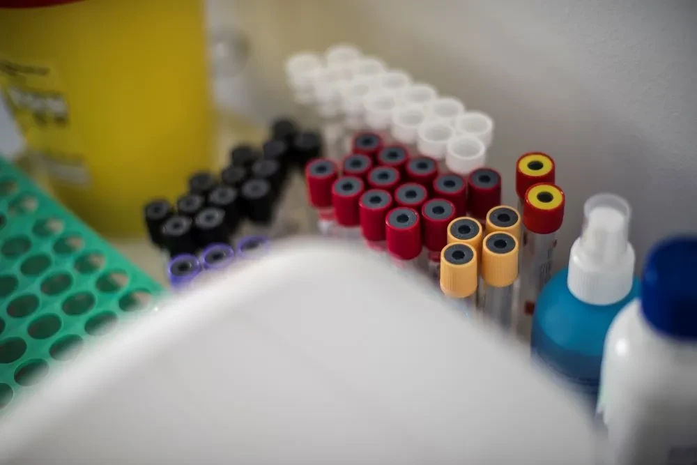 Hangi Renk Tüpe Hangi Kan Alınır?