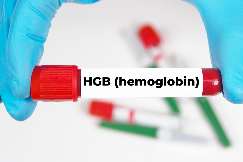 Hemoglobin Nedir ve Neden Önemlidir? Normal Değerler & Evde Takip