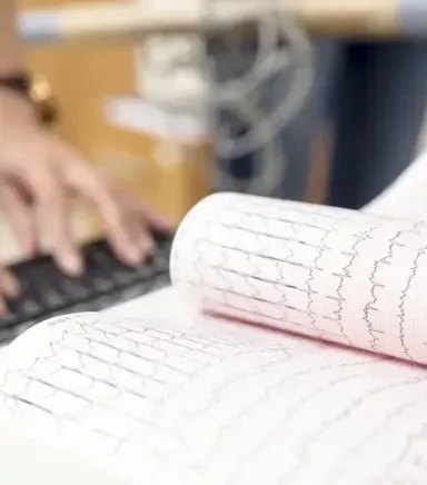 EKG Cihazı ve EKG Kağıdı Nedir?