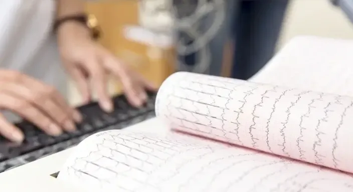 EKG Cihazı ve EKG Kağıdı Nedir?
