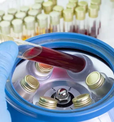 En İyi Tıbbi Santrifüj Cihazı Markaları: Karşılaştırmalı İnceleme