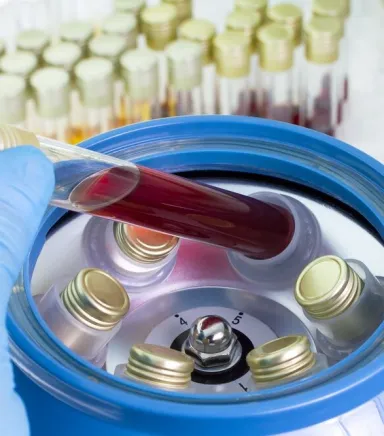 En İyi Tıbbi Santrifüj Cihazı Markaları: Karşılaştırmalı İnceleme