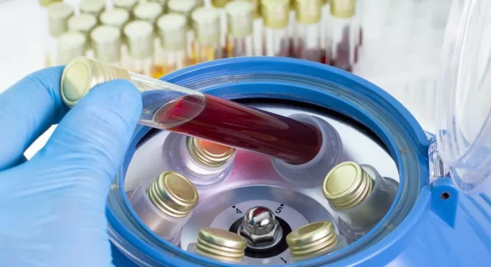 En İyi Tıbbi Santrifüj Cihazı Markaları: Karşılaştırmalı İnceleme