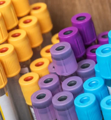 Hangi Renk Tüpe Hangi Kan Alınır?