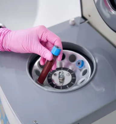 Kaliteli PRP Cihazı ile Hücresel Yenilenmede Yeni Dönem