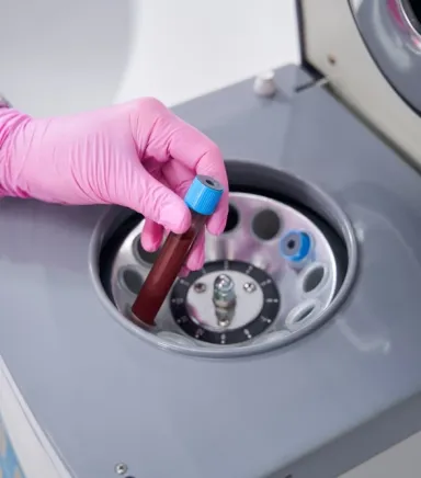 Kaliteli PRP Cihazı ile Hücresel Yenilenmede Yeni Dönem