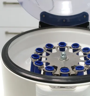 Tıbbi Santrifüj Cihazı Nasıl Çalışır? Prensipler