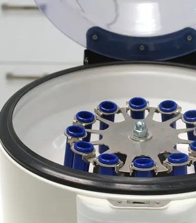 Tıbbi Santrifüj Cihazı Nasıl Çalışır? Prensipler