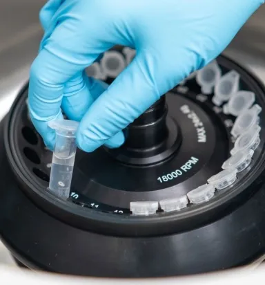 Santrifüj Cihazı Seçerken Nelere Dikkat Edilmeli?