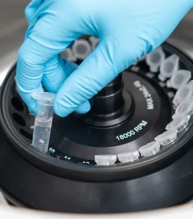 Santrifüj Cihazı Seçerken Nelere Dikkat Edilmeli?