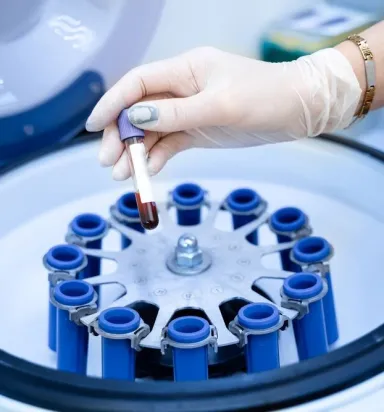 Tıbbi Santrifüj Fiyatları: Bütçenize Uygun Modeli Nasıl Bulursunuz?