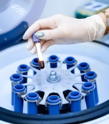 Tıbbi Santrifüj Fiyatları: Bütçenize Uygun Modeli Nasıl Bulursunuz?