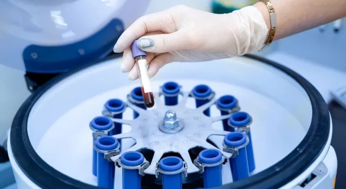 Tıbbi Santrifüj Fiyatları: Bütçenize Uygun Modeli Nasıl Bulursunuz?